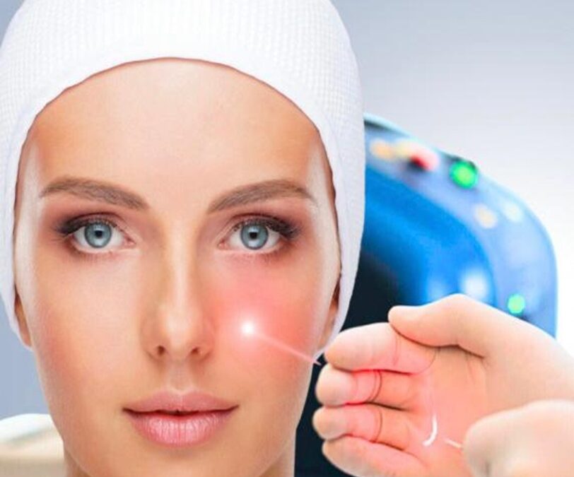 Endolaser Dermacentro